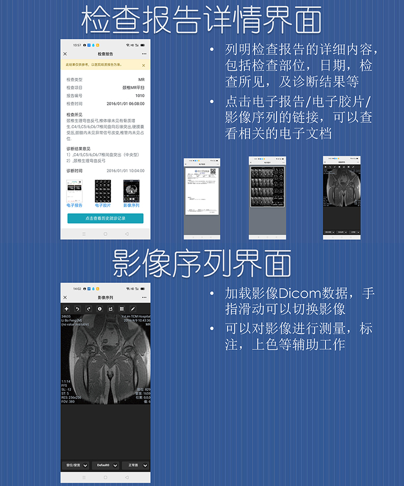 醫(yī)院放射透視檢測(cè)報(bào)告電子膠片檢查報(bào)告云管理系統(tǒng)軟件開發(fā)APP小程序定制 醫(yī)院放射透視檢測(cè)報(bào)告電子膠片檢查報(bào)告云管理系統(tǒng)軟件開發(fā)APP小程序定制