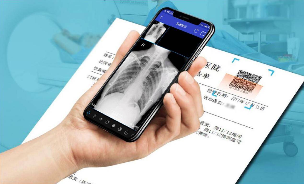 云膠片是什么？